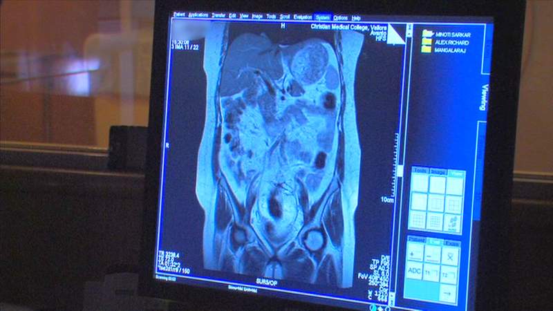 photo of screen showing mri wth the machine just visible in the background